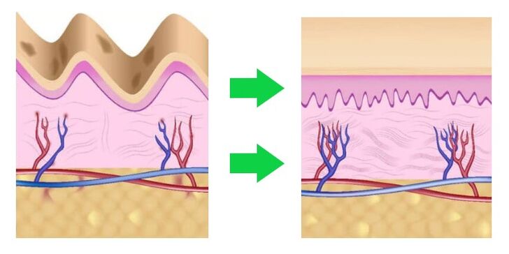 Intenskin aligns the skin