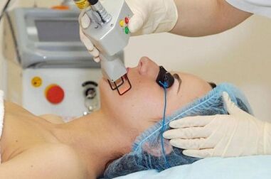 types of laser facial skin rejuvenation